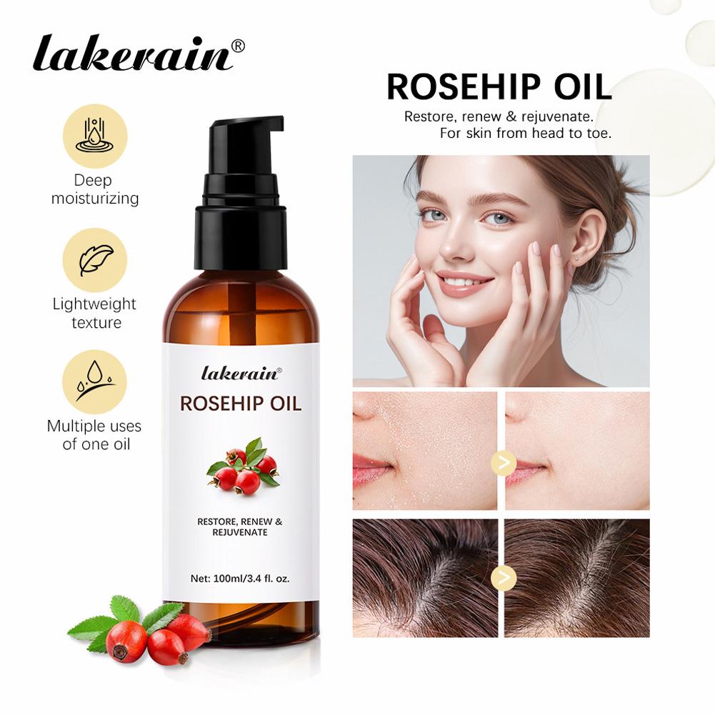 Cold Pressed Rose Hip - น้ำมันโรสฮิปสำหรับผิวหน้าและผิว น้ำมันเมล็ดโรสฮิปออร์แกนิกสำหรับนวดกัวซา น้ำมันโรสฮิปสกัดเย็นบริสุทธิ์สำหรับรอยแผลเป็นจากสิว F7V4