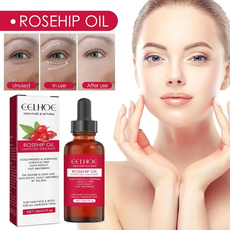 Cold Pressed Rose Hip - 30ml Organic Rosehip Seed Oil สําหรับใบหน้า