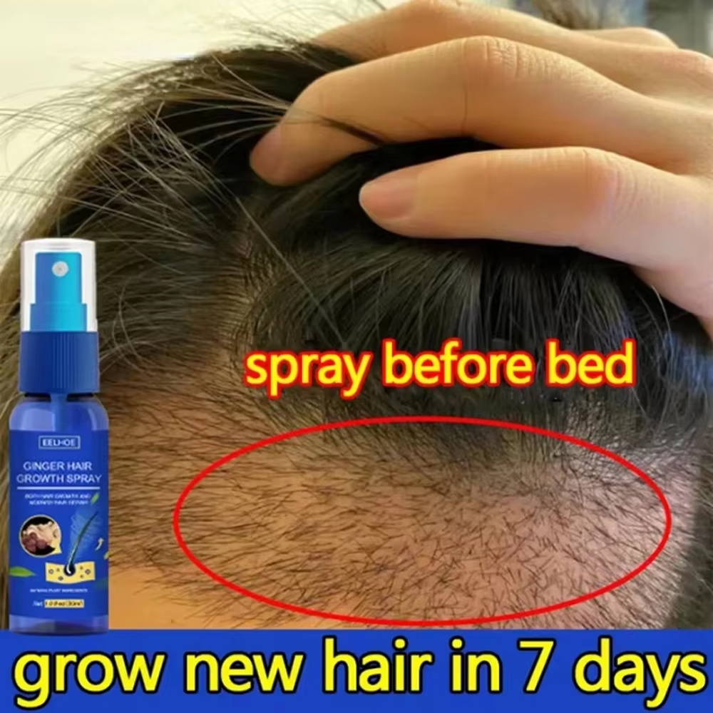 Growth Factor Serum - สเปรย์เร่งผมยาวขึ้นอย่างรวดเร็ว บำรุงรากผม ป้องกันผมร่วง เซรั่มปลูกผมใหม่ ซ่อมแซมหนังศีรษะที่เสียหาย บำรุงและดูแลเส้นผม