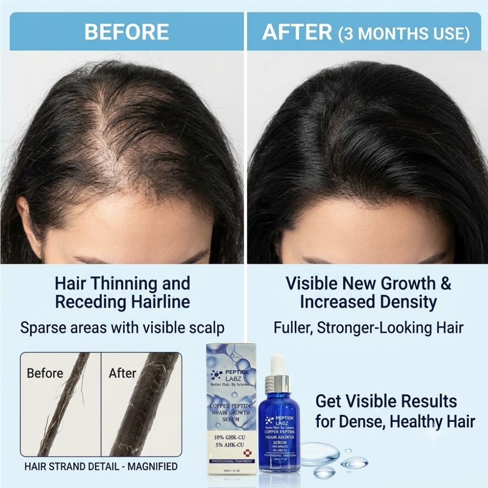 เอสเซนส์บำรุงเส้นผม คอปเปอร์ เ - Growth Factor Serum บทวิจารณ์และราคา