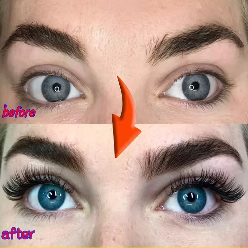 Fast Eyelash Growth Serum 7 วั - Growth Factor Serum บทวิจารณ์และราคา